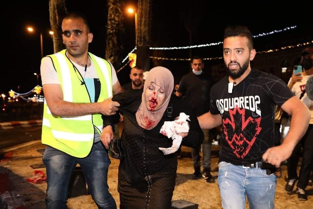 المقدسية زينب سليمان.. نزيفُ دمها أصاب قلوبَ الفلسطينيين بالحسرة